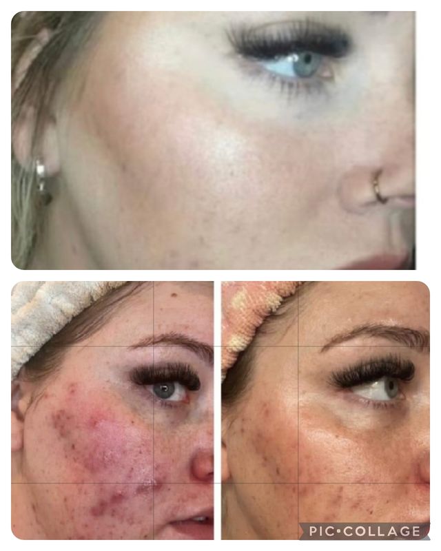 Featured photo from Studio Treatment